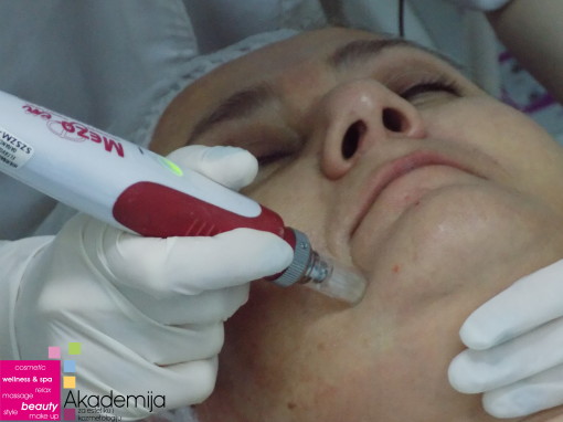 PRIMENA MEZOTERAPIJE U TRETMANU LICA – sa nastave na predmetu Medicinska kozmetika