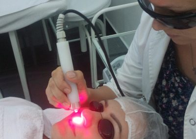 tretiranje ožiljaka laserom