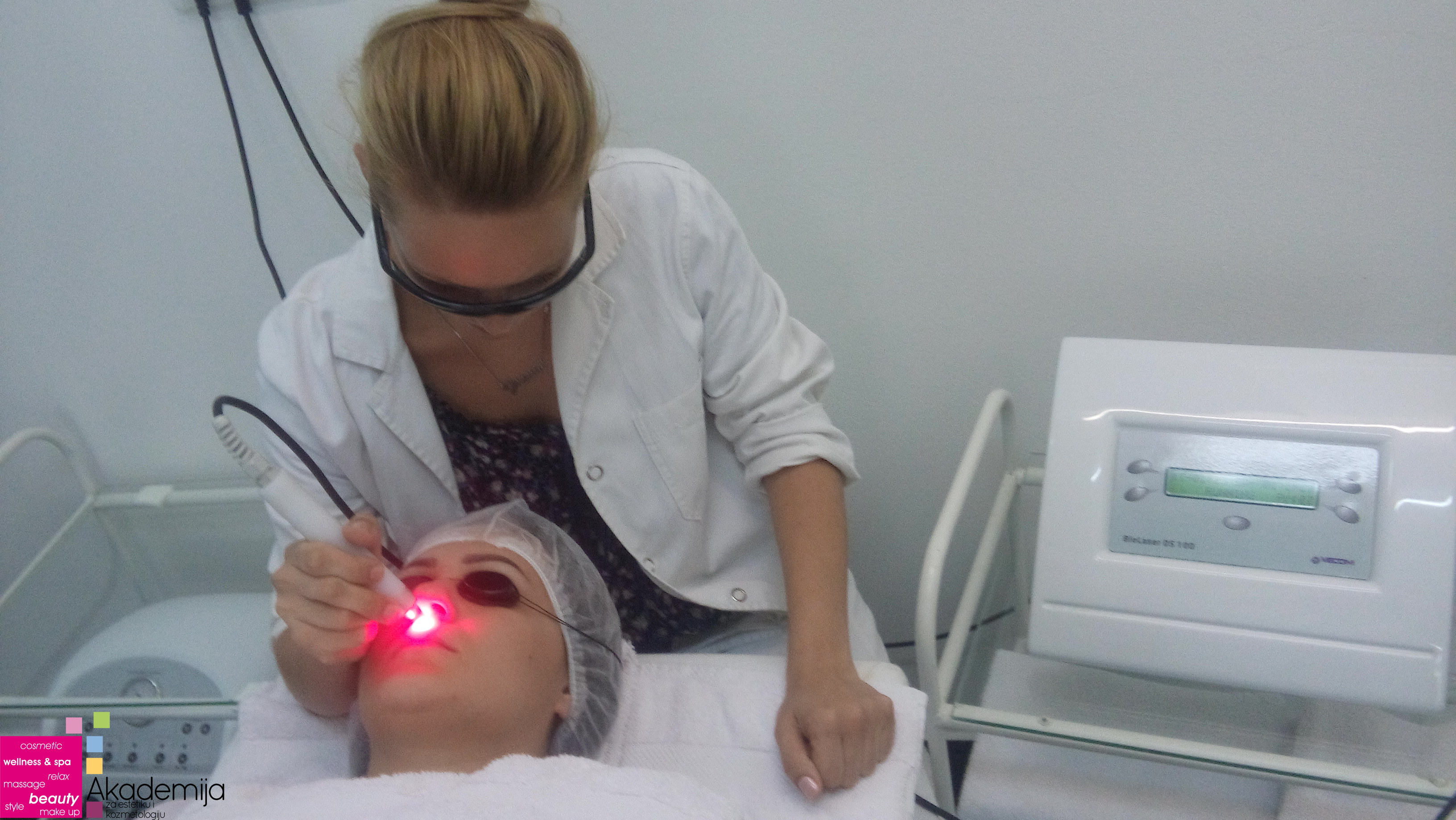 TRETIRANJE OŽILJAKA LASEROM – uklanjanje ožiljaka od akni laserom