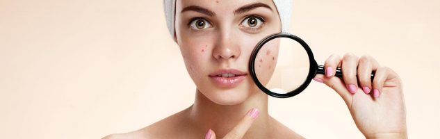 Antibiotici i preparati za aknoznu kožu