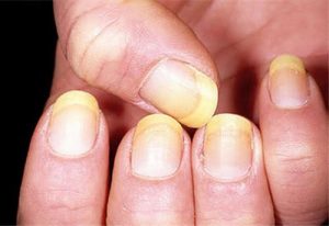 nokti nokti nokti nokti nokti nokti nokti nokti nokti nokti nokti nokti nokti nokti nokti nokti